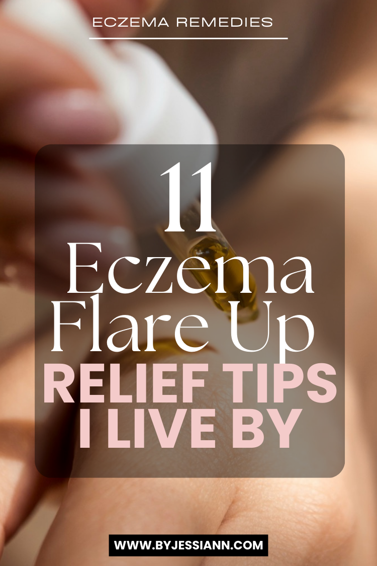 eczema flare up