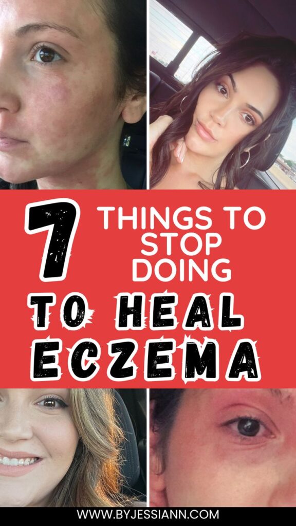 THINGS TO AVOID IF YOU HAVE ECZEMA